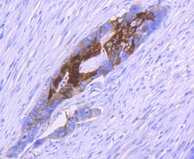 S100A10 Antibody in Immunohistochemistry (Paraffin) (IHC (P))