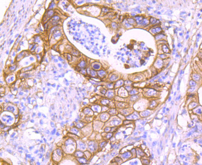 S100A10 Antibody in Immunohistochemistry (Paraffin) (IHC (P))