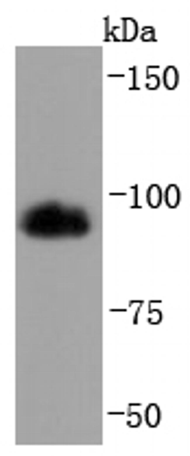 HMGCR Antibody in Western Blot (WB)