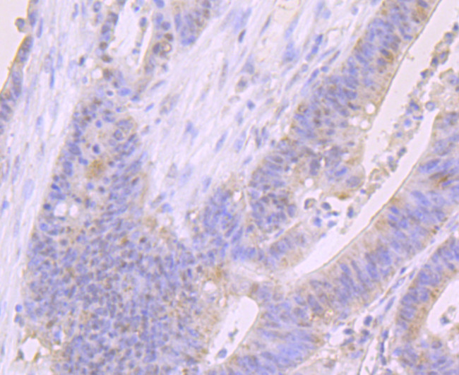 FOXP1 Antibody in Immunohistochemistry (Paraffin) (IHC (P))