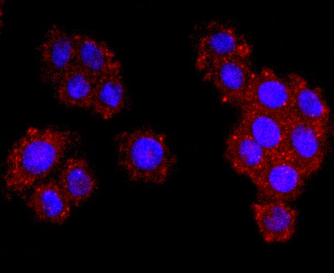 Dysferlin Antibody in Immunocytochemistry (ICC/IF)