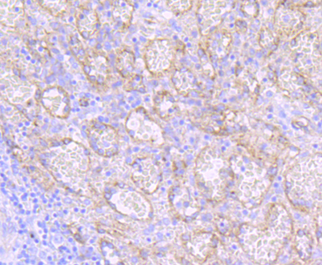 Dysferlin Antibody in Immunohistochemistry (Paraffin) (IHC (P))