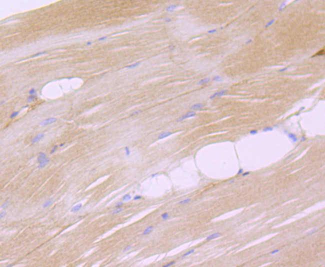 Dysferlin Antibody in Immunohistochemistry (Paraffin) (IHC (P))