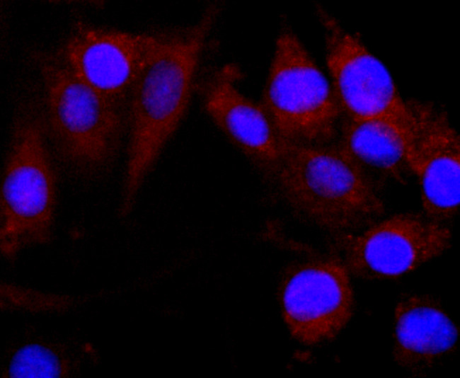 CNPase Antibody in Immunocytochemistry (ICC/IF)