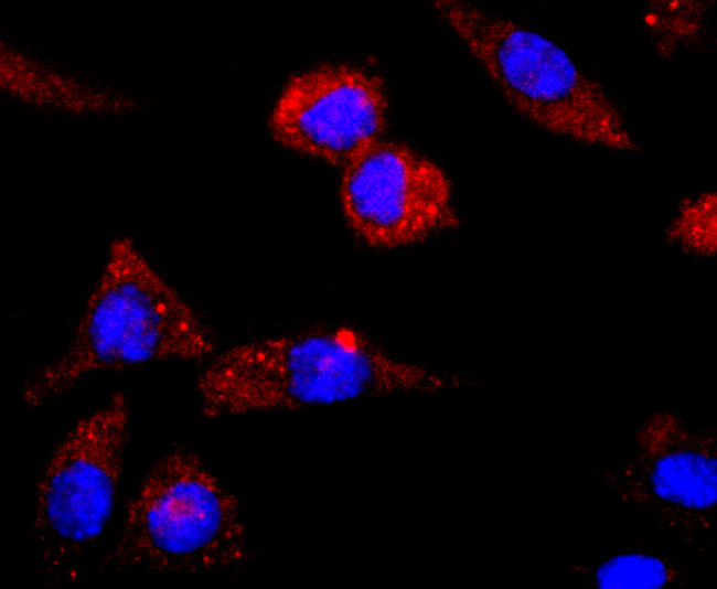 CNPase Antibody in Immunocytochemistry (ICC/IF)