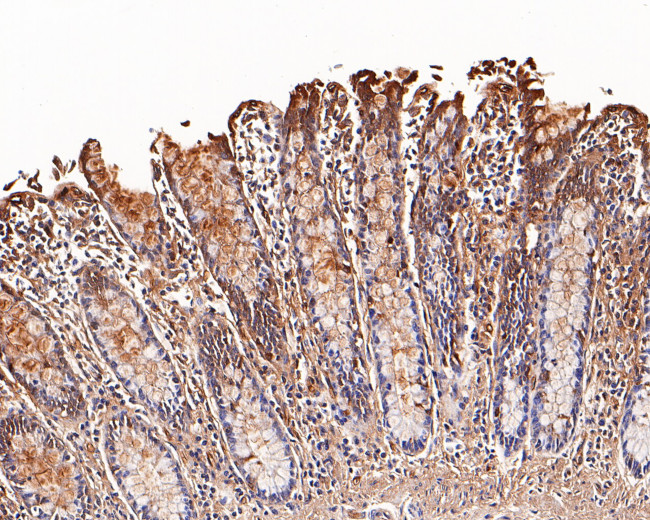 Galectin 3 Antibody in Immunohistochemistry (Paraffin) (IHC (P))