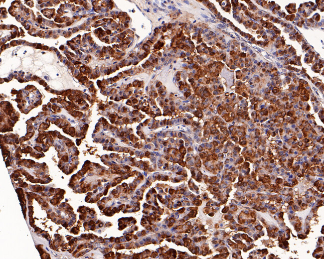 Galectin 3 Antibody in Immunohistochemistry (Paraffin) (IHC (P))