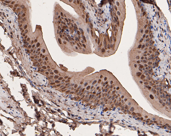 Galectin 3 Antibody in Immunohistochemistry (Paraffin) (IHC (P))