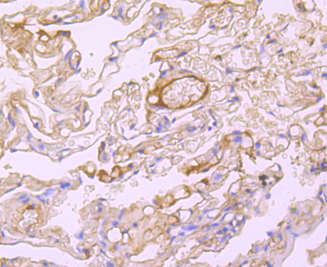 Albumin Antibody in Immunohistochemistry (Paraffin) (IHC (P))