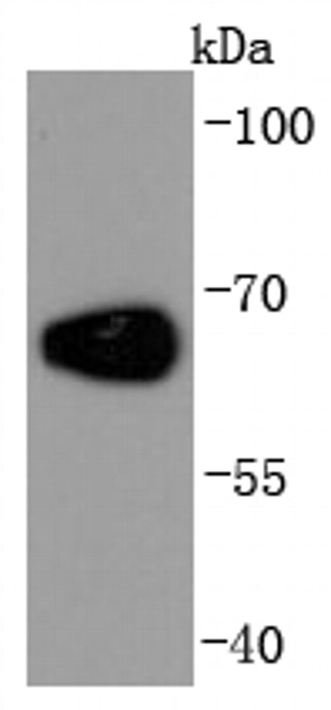 Albumin Antibody in Western Blot (WB)