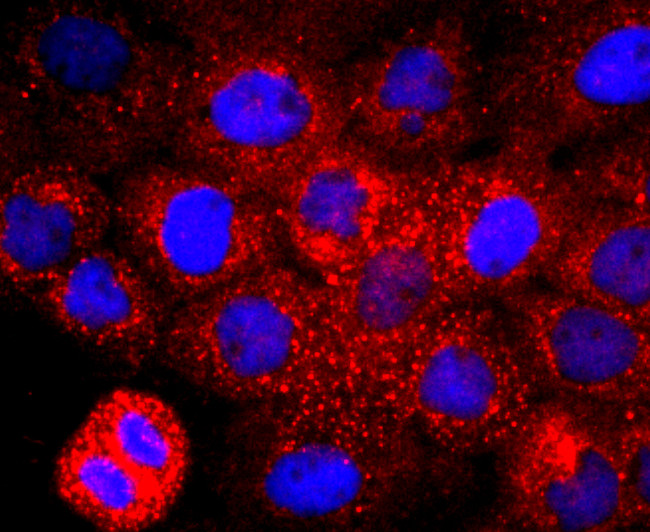 CD147 Antibody in Immunocytochemistry (ICC/IF)