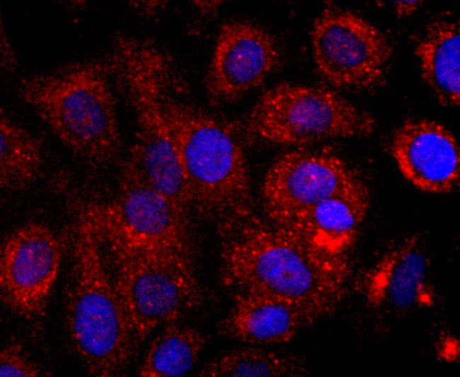 CD147 Antibody in Immunocytochemistry (ICC/IF)