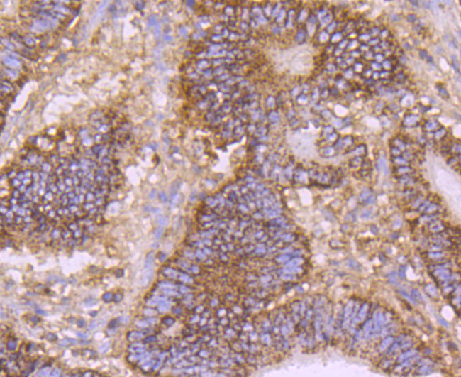 CD147 Antibody in Immunohistochemistry (Paraffin) (IHC (P))