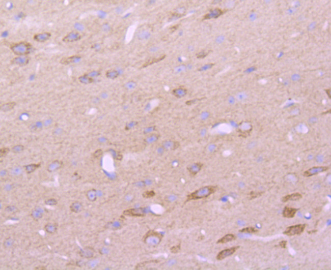 CD147 Antibody in Immunohistochemistry (Paraffin) (IHC (P))