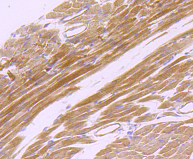 CD147 Antibody in Immunohistochemistry (Paraffin) (IHC (P))