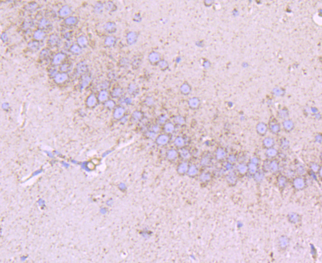 CD147 Antibody in Immunohistochemistry (Paraffin) (IHC (P))