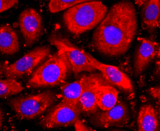 WFDC2 Antibody in Immunocytochemistry (ICC/IF)