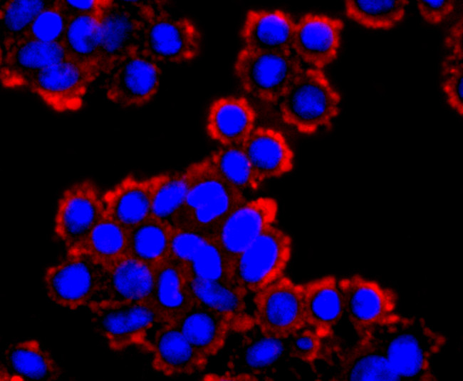 WFDC2 Antibody in Immunocytochemistry (ICC/IF)