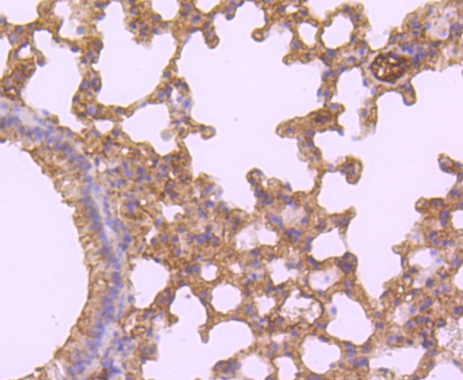 WFDC2 Antibody in Immunohistochemistry (Paraffin) (IHC (P))