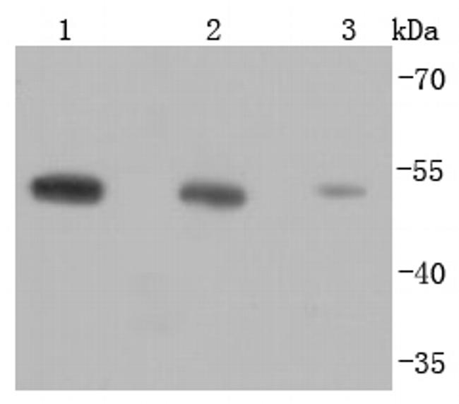 beta Tubulin Antibody in Western Blot (WB)