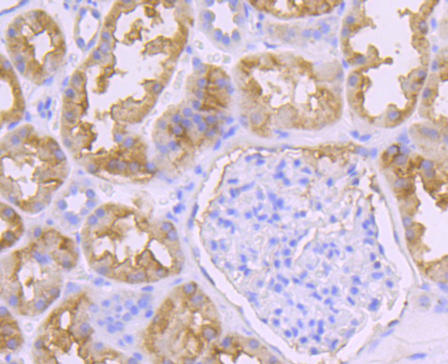 PDHA1 Antibody in Immunohistochemistry (Paraffin) (IHC (P))