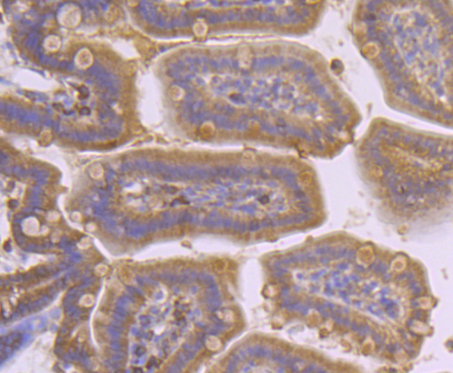 PDHA1 Antibody in Immunohistochemistry (Paraffin) (IHC (P))