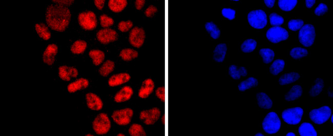 DNMT1 Antibody in Immunocytochemistry (ICC/IF)