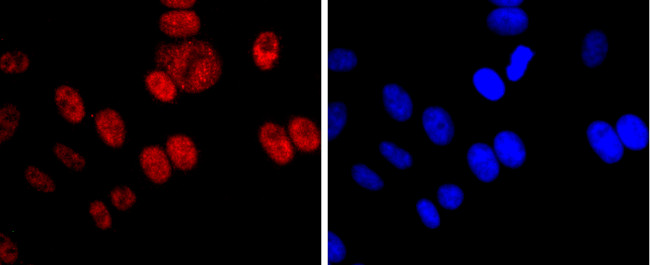 DNMT1 Antibody in Immunocytochemistry (ICC/IF)