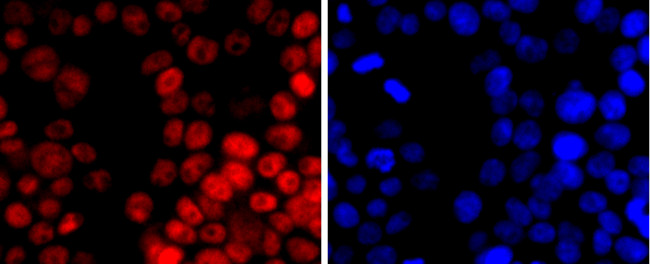 DNMT1 Antibody in Immunocytochemistry (ICC/IF)