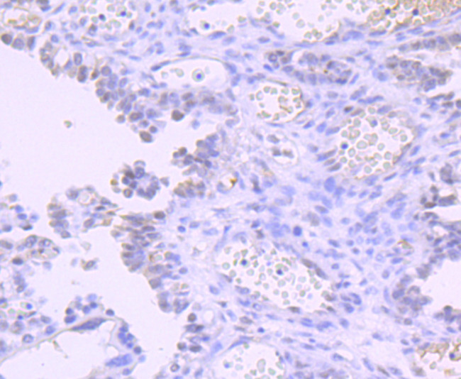 DNMT1 Antibody in Immunohistochemistry (Paraffin) (IHC (P))