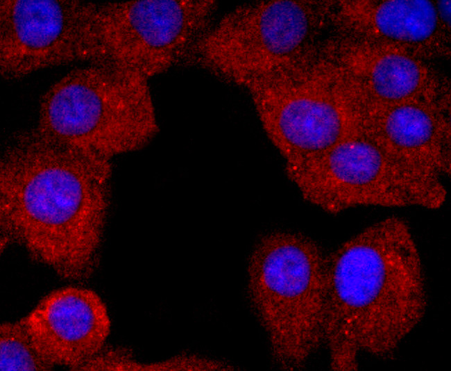 Neutrophil elastase Antibody in Immunocytochemistry (ICC/IF)