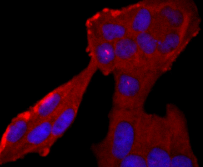 Neutrophil elastase Antibody in Immunocytochemistry (ICC/IF)