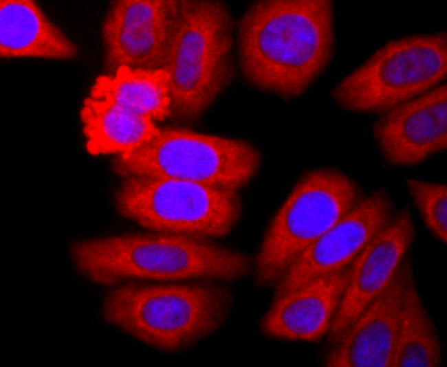 Neutrophil elastase Antibody in Immunocytochemistry (ICC/IF)