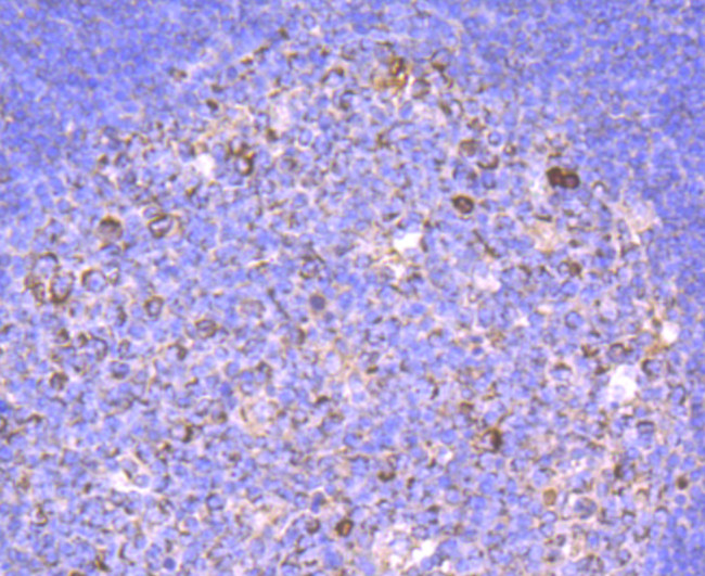 Human IgM Antibody in Immunohistochemistry (Paraffin) (IHC (P))