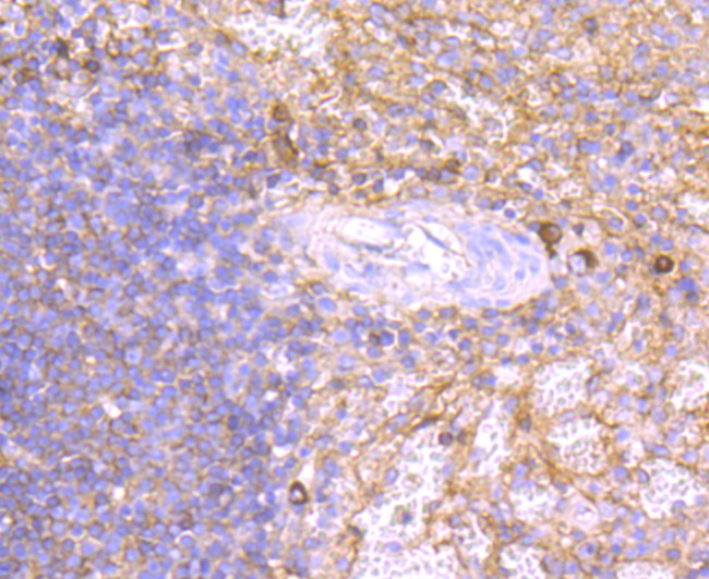 Human IgM Antibody in Immunohistochemistry (Paraffin) (IHC (P))