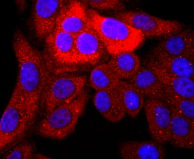 S100P Antibody in Immunocytochemistry (ICC/IF)