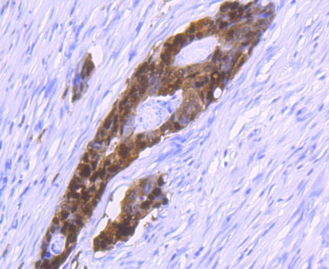 S100P Antibody in Immunohistochemistry (Paraffin) (IHC (P))