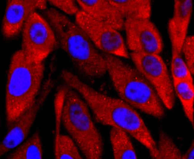 PGP9.5 Antibody in Immunocytochemistry (ICC/IF)