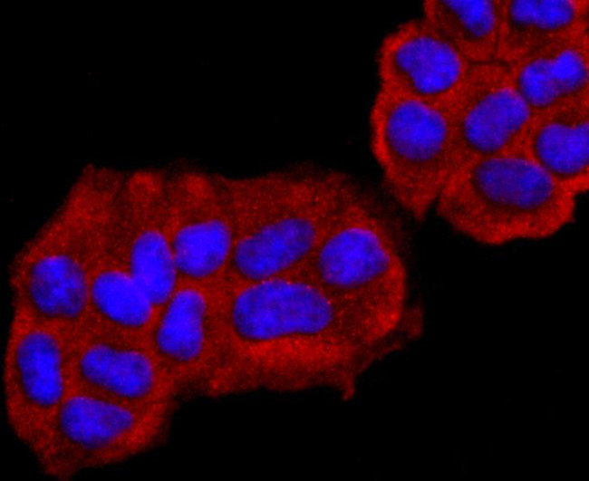 PGP9.5 Antibody in Immunocytochemistry (ICC/IF)