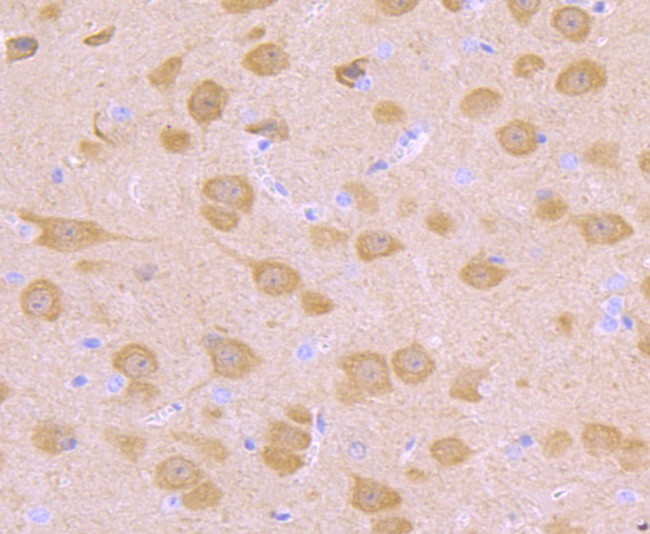 PGP9.5 Antibody in Immunohistochemistry (Paraffin) (IHC (P))