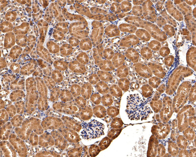 Thioredoxin 1 Antibody in Immunohistochemistry (Paraffin) (IHC (P))