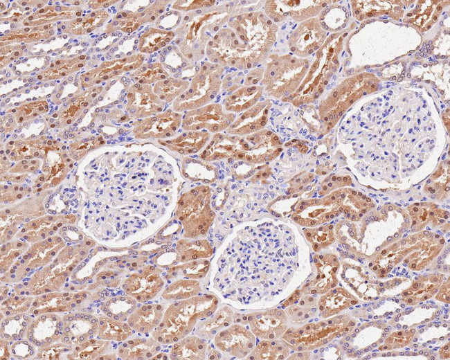 Thioredoxin 1 Antibody in Immunohistochemistry (Paraffin) (IHC (P))