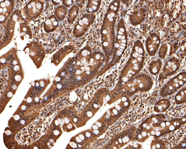 Thioredoxin 1 Antibody in Immunohistochemistry (Paraffin) (IHC (P))