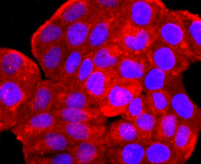 ARF6 Antibody in Immunohistochemistry (Paraffin) (IHC (P))