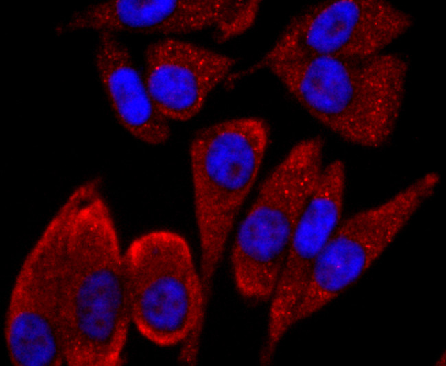 CD19 Antibody in Immunocytochemistry (ICC/IF)