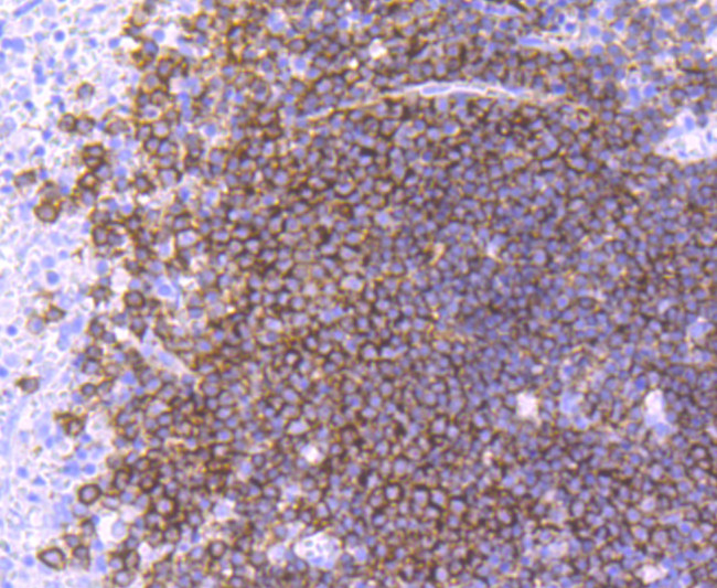 CD19 Antibody in Immunohistochemistry (Paraffin) (IHC (P))