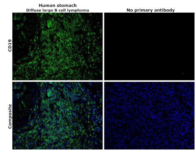 CD19 Antibody in Immunohistochemistry (Paraffin) (IHC (P))