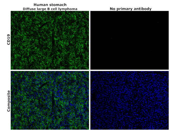 CD19 Antibody in Immunohistochemistry (Paraffin) (IHC (P))