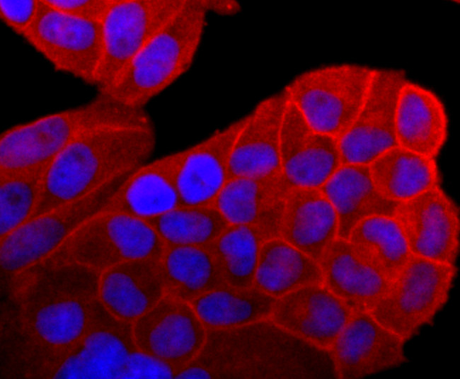 Pan Ras Antibody in Immunocytochemistry (ICC/IF)