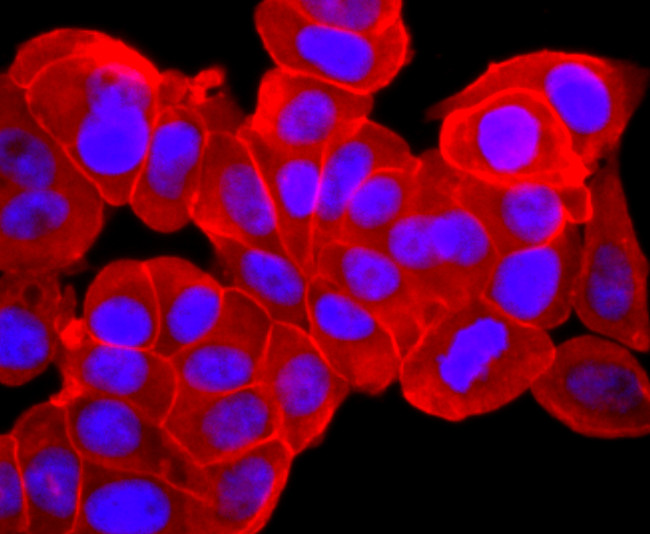 Pan Ras Antibody in Immunocytochemistry (ICC/IF)